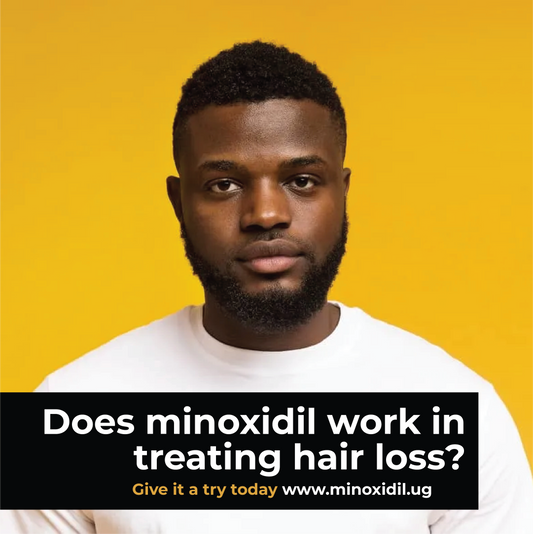 Does Minoxidil Really Work?